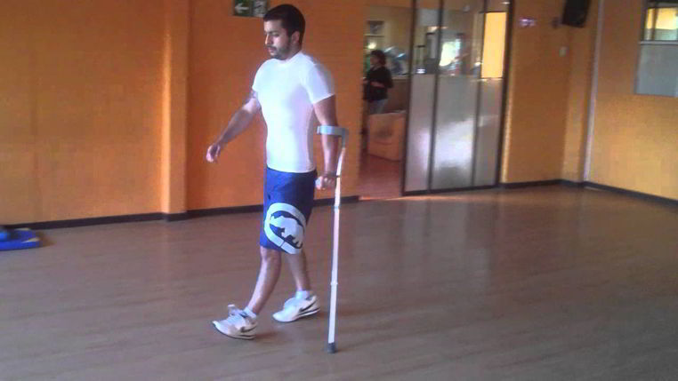 fractura de perone en adultos